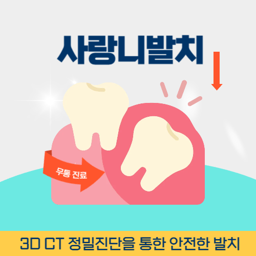 보령치과 보령시 치과 사랑니 발치